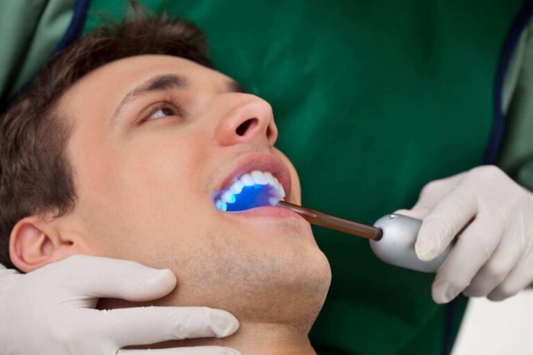 Close-up-of-dentist-applying-UV-light-to-patients-mouth-to-cure-bonding-procedure