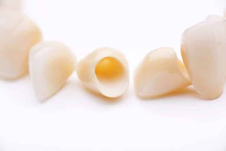 Close-up of several prosthetic teeth on white surface