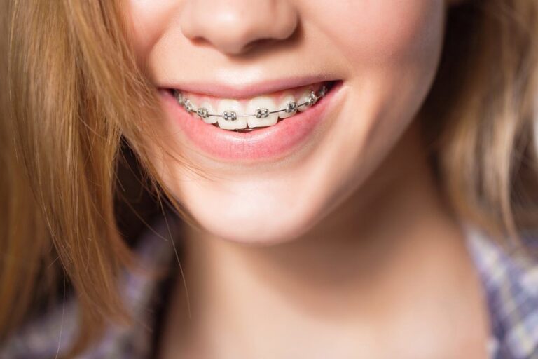 Close up portrait of smiling teen girl showing dental braces