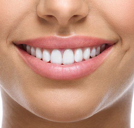 Teeth-Whitening