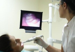 intraoralcamera