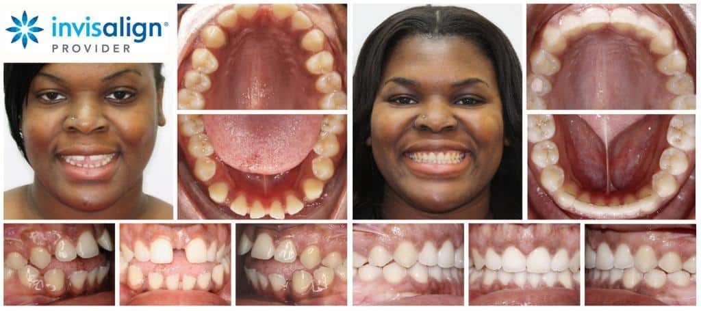 Wilkinson Dental