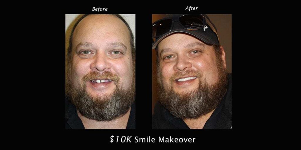 10k-smile makeover