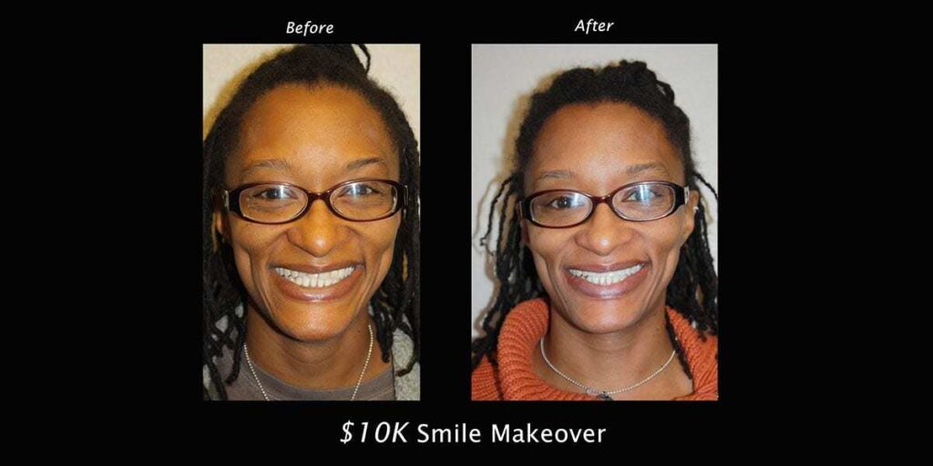 10k-smile makeover