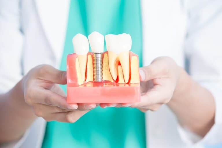 Close-up-of-dentist-holding-a-model-of-a-dental-implant-between-two-natural-teeth