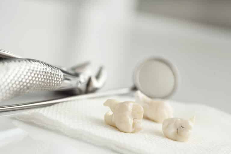 Extracted-wisdom-teeth-on-white-paper-towel-dental-tools-behind