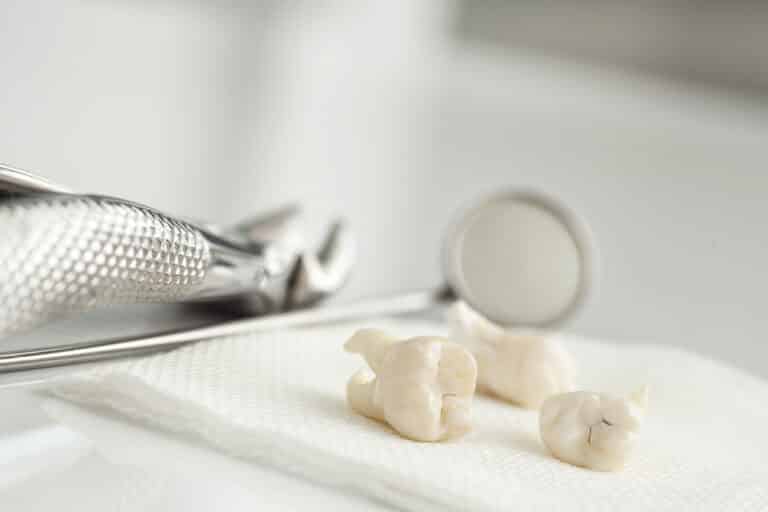 Extracted-wisdom-teeth-on-white-paper-towel-dental-tools-behind