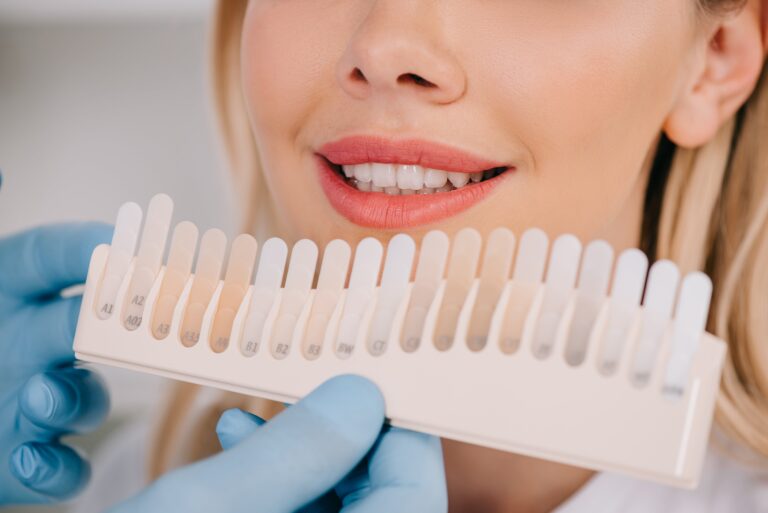 Dental professional holding up tooth shade guide to teeth of patient