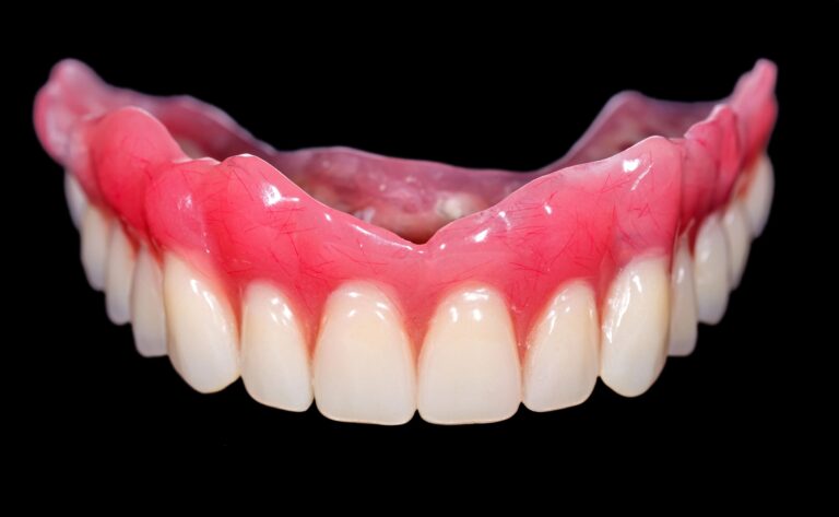 Close-up of upper dentures on black background